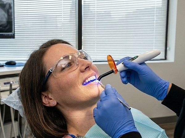 Can You Fix Chipped or Cracked Teeth with Dental Bonding in Nashville?