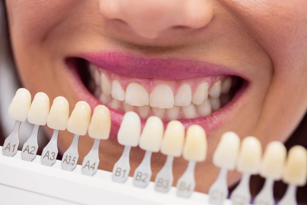 When Should You Replace Missing Teeth with Dental Implants in Nashville?