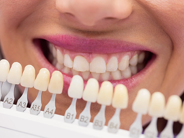 When Should You Replace Missing Teeth with Dental Implants in Nashville?