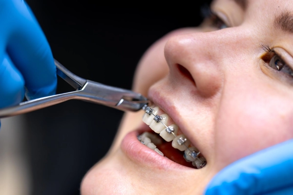 Orthodontic Care in Nashville