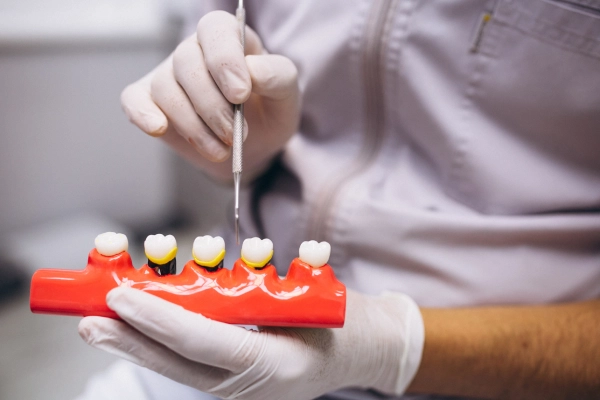 Dental Implants in Nashville