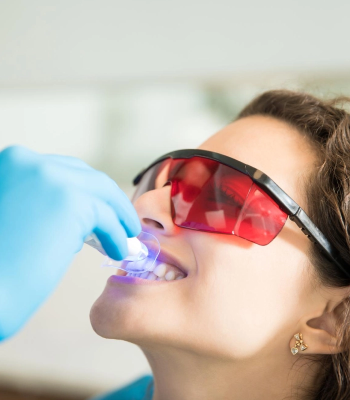 Restorative Treatment—Tooth-Colored Fillings/Bonding