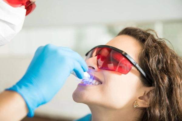 Tooth-Colored Fillings & Dental Bonding in Nashville